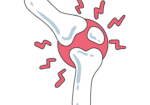 Rheumatology signs and symptoms